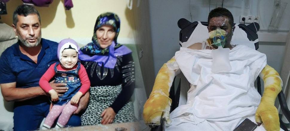 Yangında ailesini yanmaktan kurtardı... Kendisi yanarak hastanelik oldu!