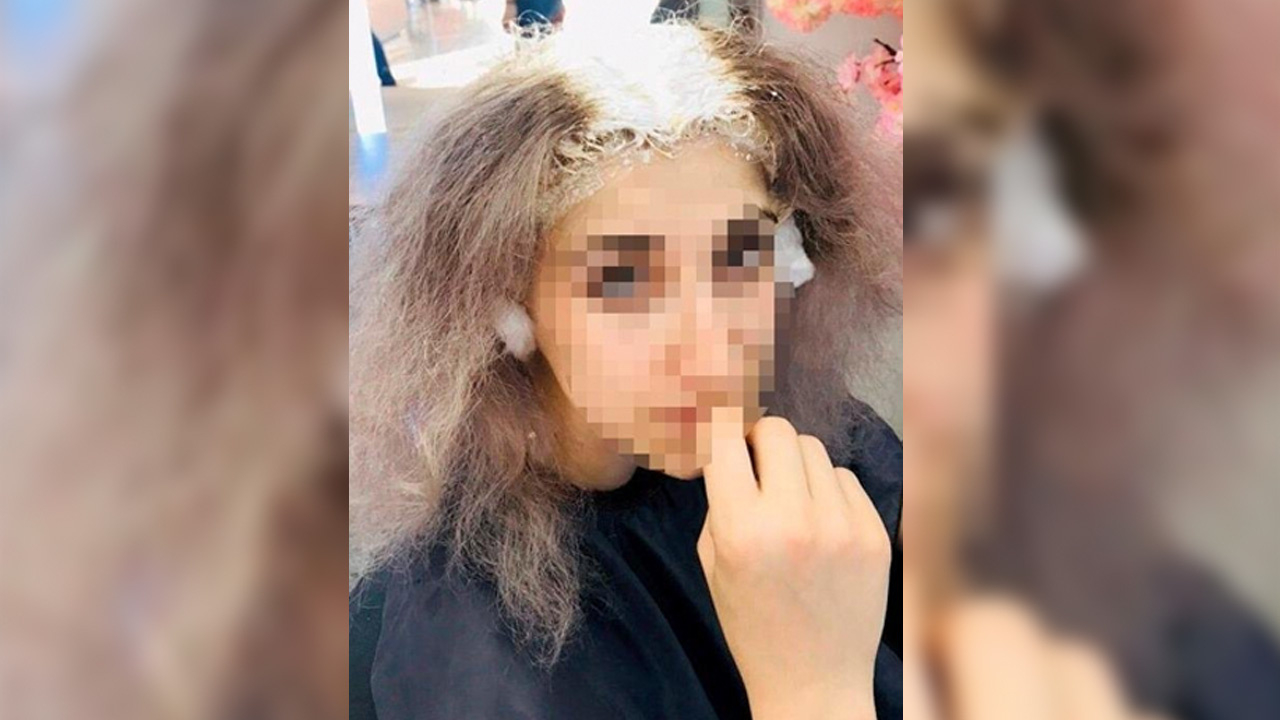 Saçlarını boyatmak için kuaföre gitti kafatası derisi yandı!