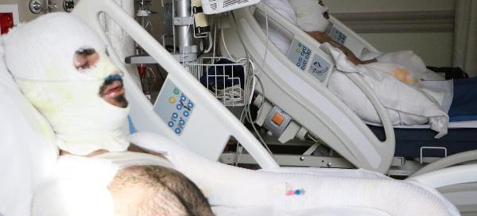 Her şey bir anda oldu! Yangından böyle kurtuldular
