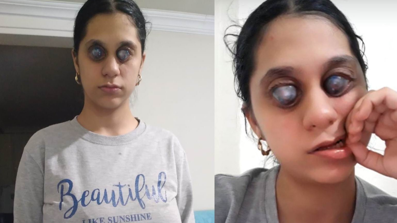 Photoshop değil gerçek... Ümran yardım bekliyor