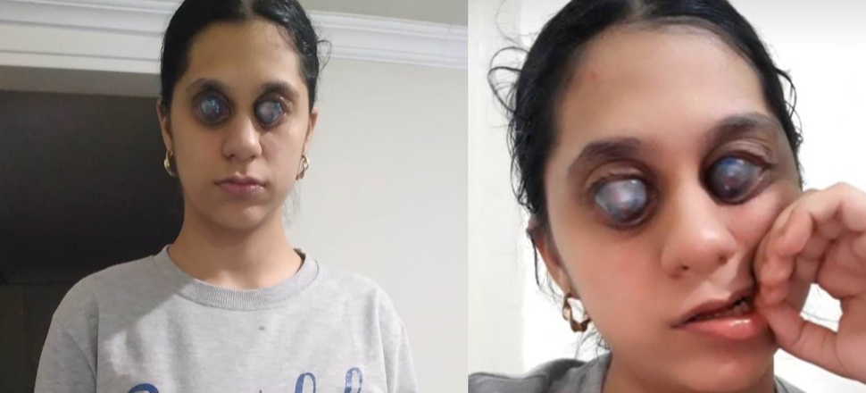 Photoshop değil gerçek... Ümran yardım bekliyor