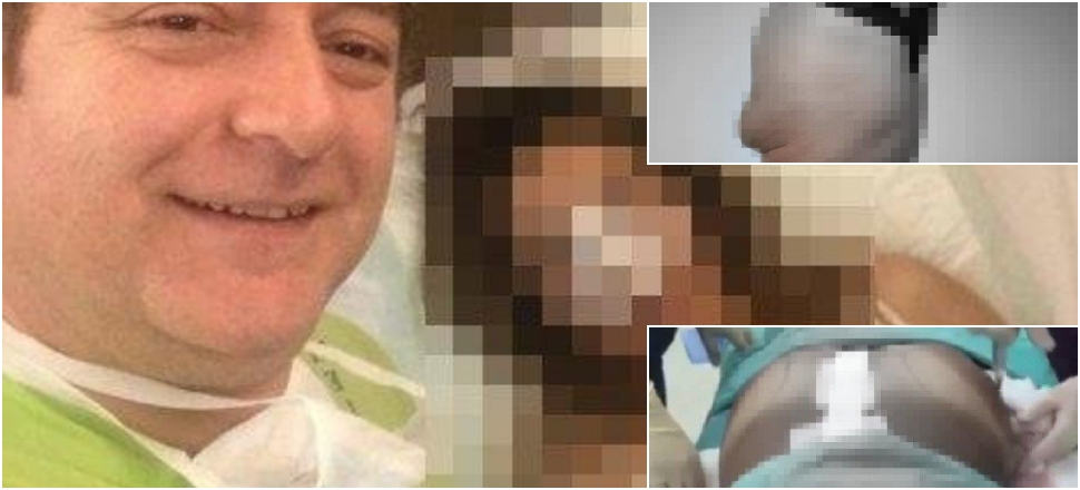 Güzel kalça hayali kabusla bitti