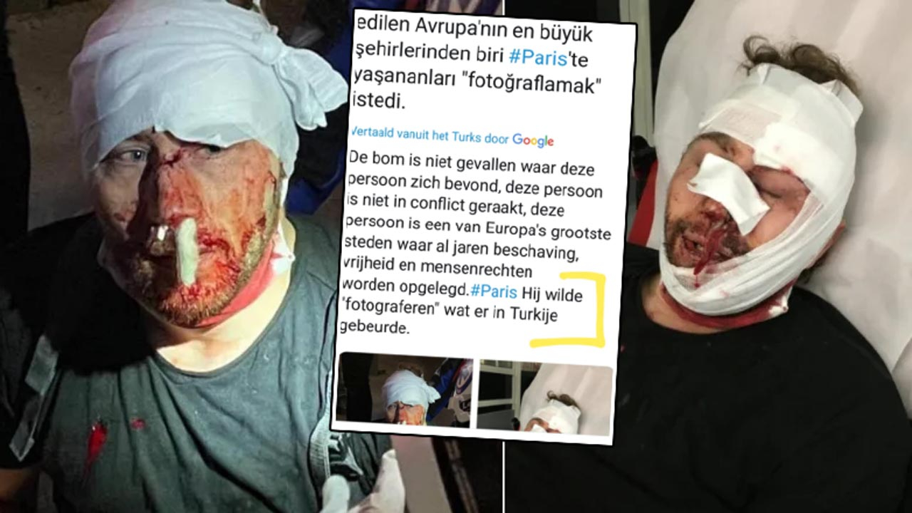 Fransa'da yaşanan iğrenç saldırıyı Türkiye'de olmuş gibi çevirdiler!