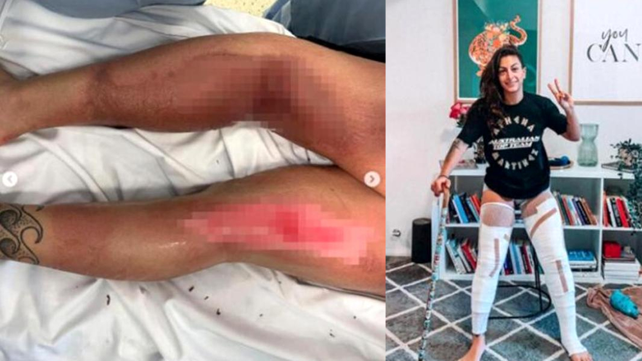 Ünlü dövüşçü az kalsın bacaklarını kaybediyordu