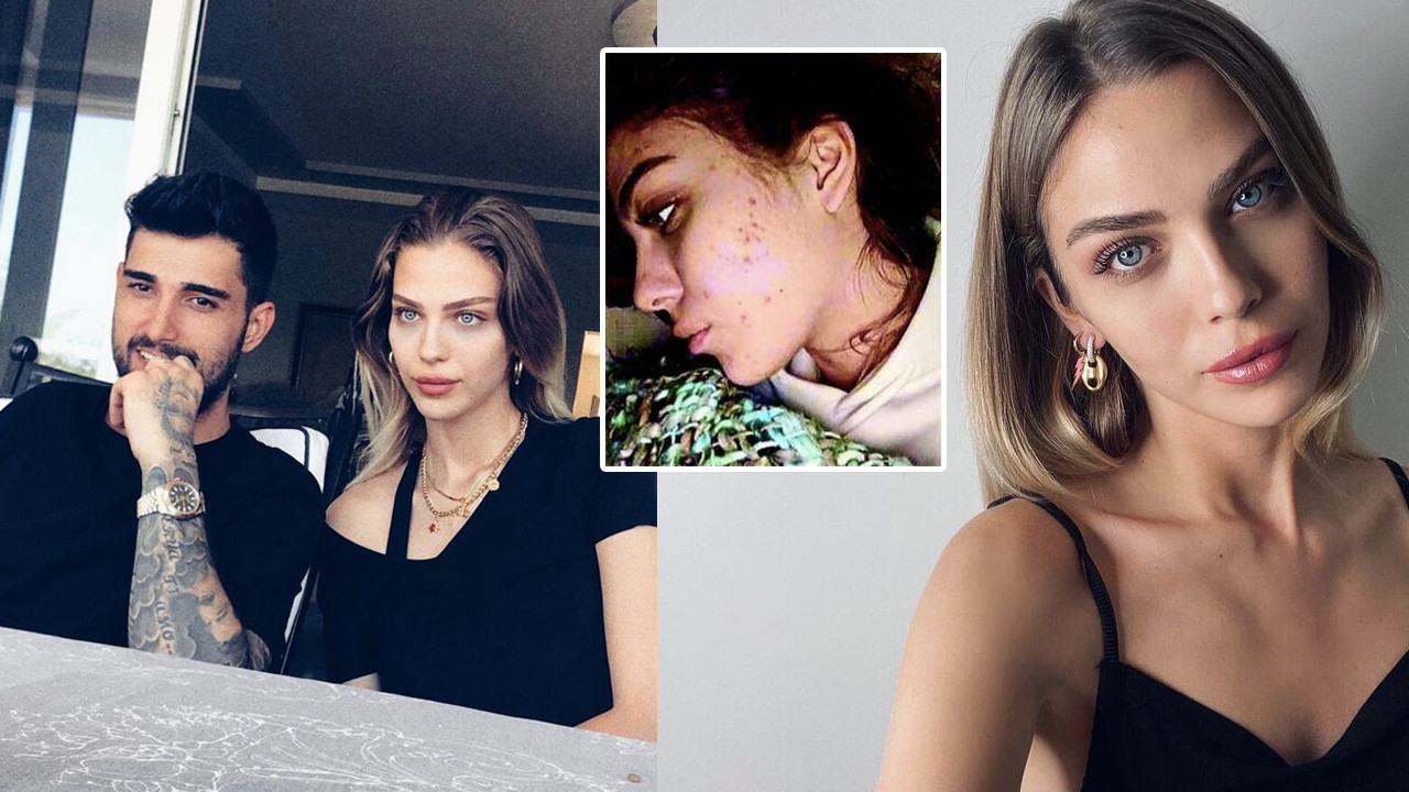 Yasemin Şefkatli takipçilerini uyardı: Bilmediğiniz ürünleri kullanmayın...