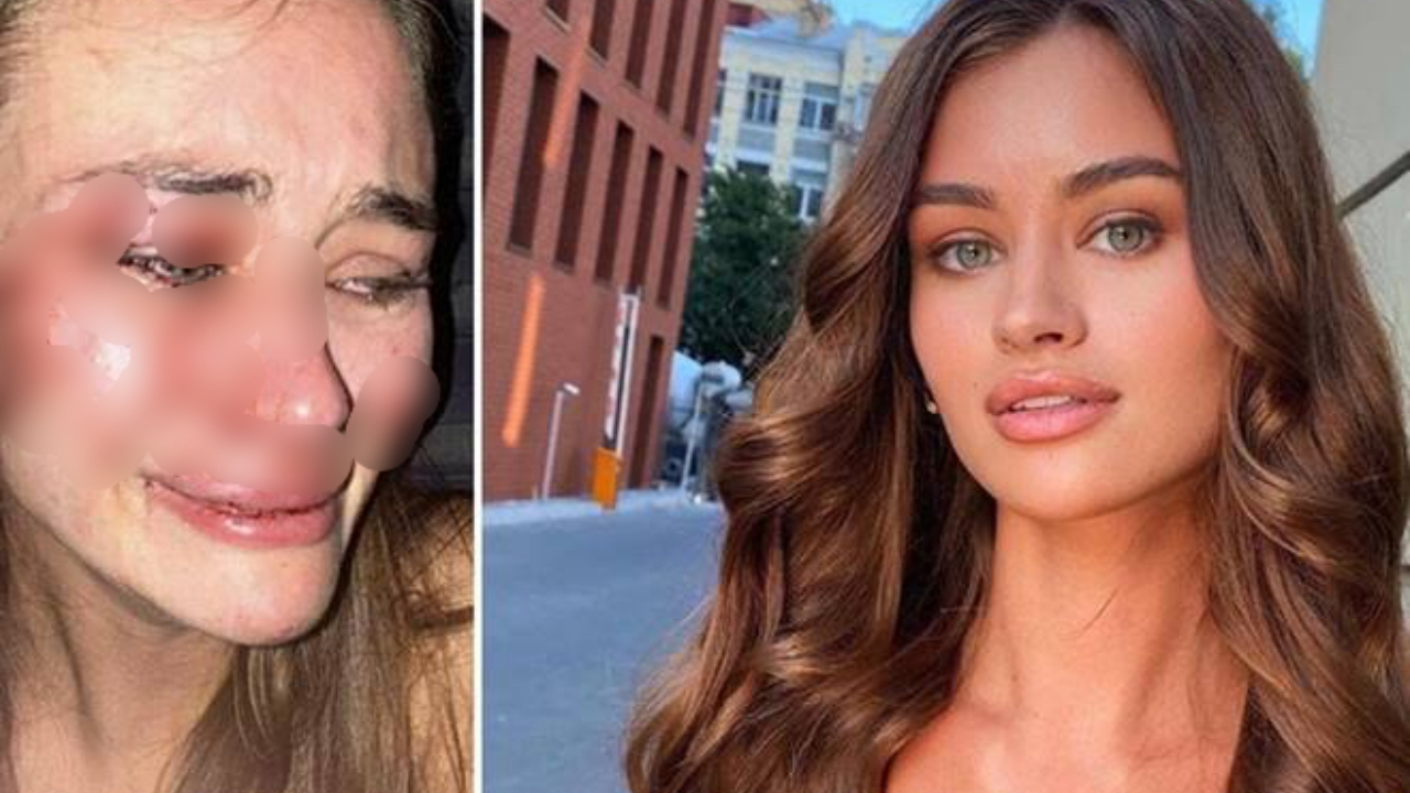 Darp edildiğini iddia eden Ukraynalı model Daria şikayetini geri çekti
