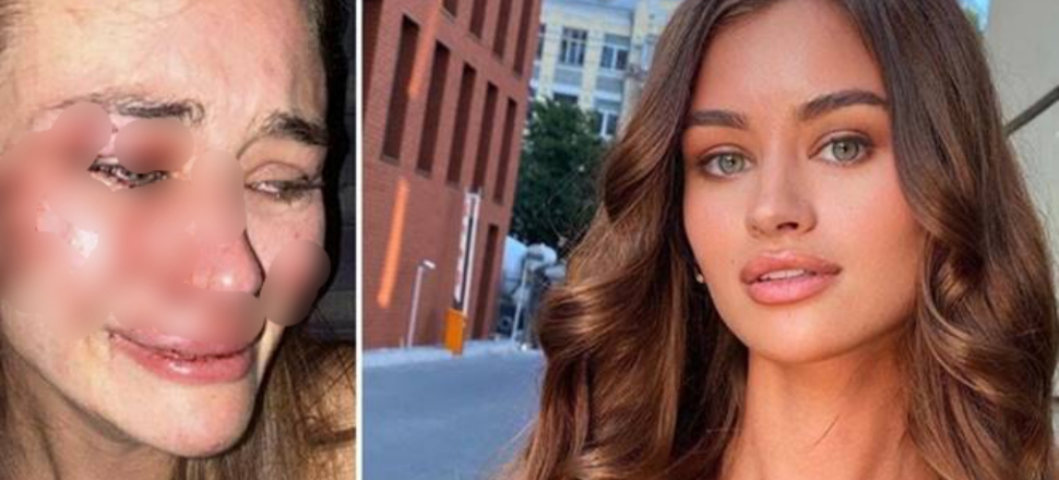 Darp edildiğini iddia eden Ukraynalı model Daria şikayetini geri çekti