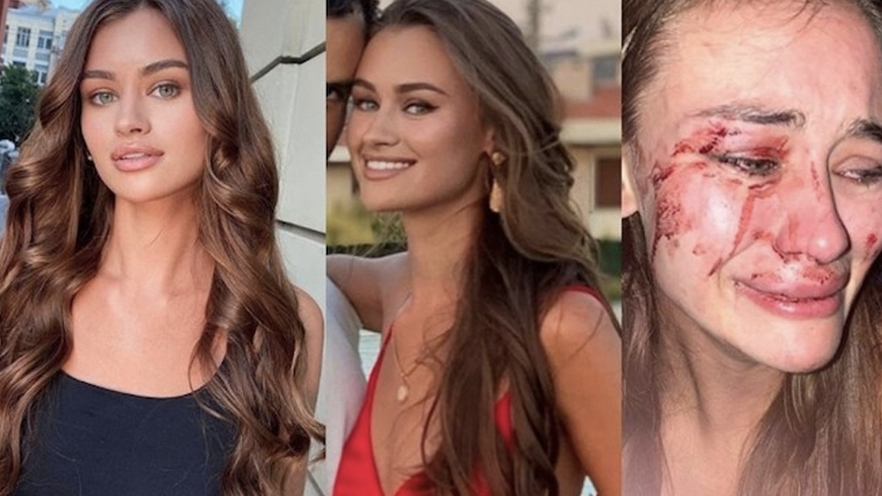 Ukraynalı top model Türkiye'yi terk etti! 'Türkiye'ye bir daha dönmem'