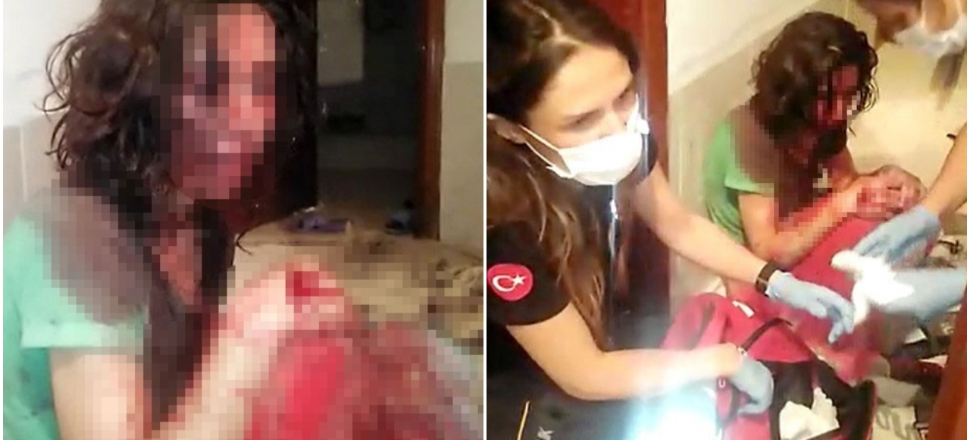 Karısını bu hale getirip 'Kendi yaptı' dedi!