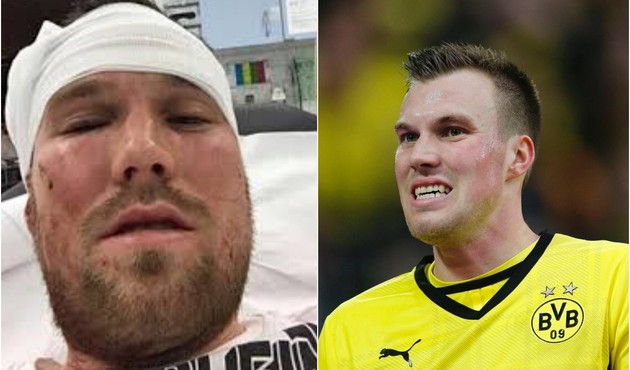 Kevin Grosskreutz'u 16 yaşında bir Türk dövmüş!