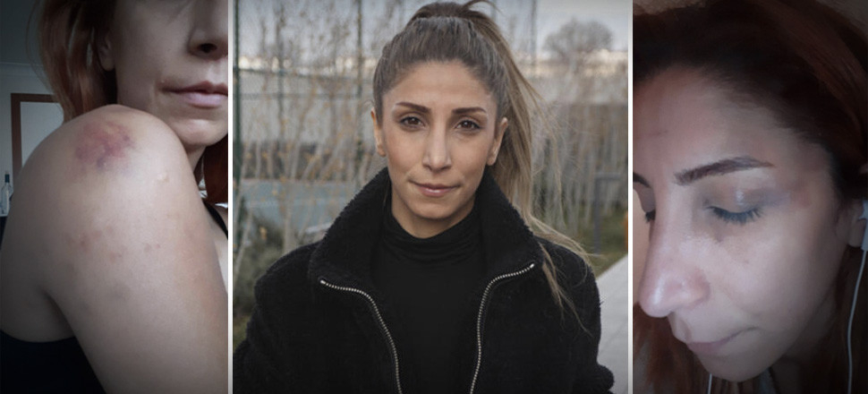 Veterinere sevgili şiddeti! Genç kadın kabusu anlattı...