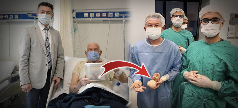 Mesanesinden çıkan 2,5 kilo ağırlığındaki taşları hatıra olarak aldı!
