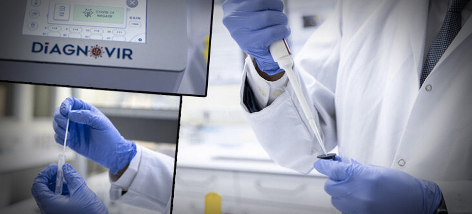 Türk araştırmacılar koronavirüs teşhisini 10 saniyede yapabilen nanoteknoloji temelli tanı sistemi geliştirdi...