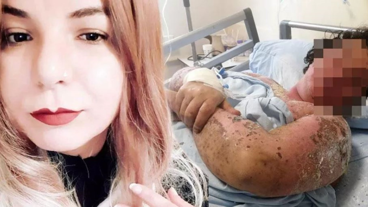 Yanlış antibiyotik kullanımı hayatını zindana çevirdi!