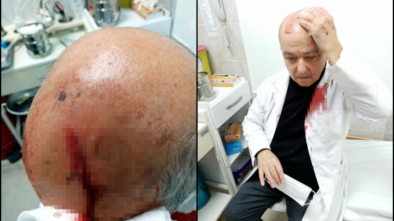 Maske uyarısı yapan doktoru taşladılar