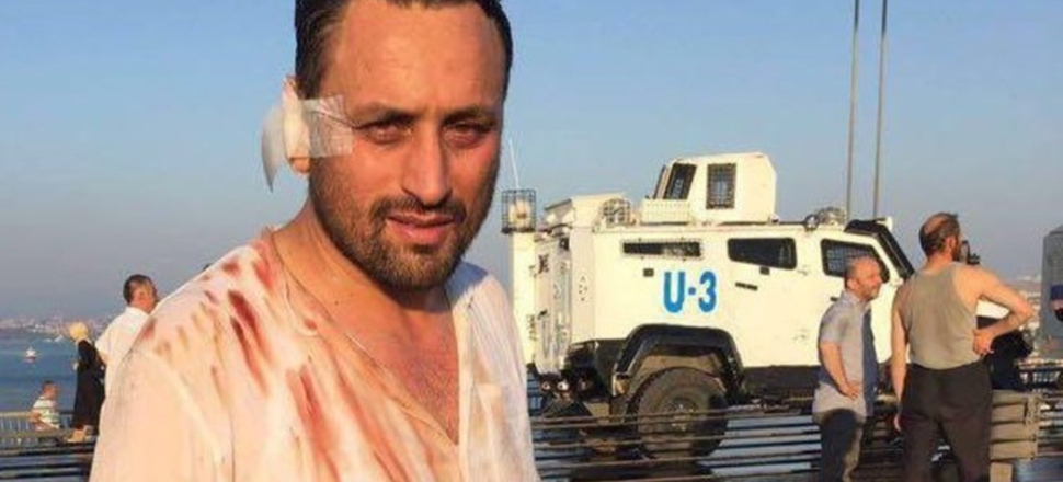 İBB, 15 Temmuz Gazisi’ni ekmeğinden etti
