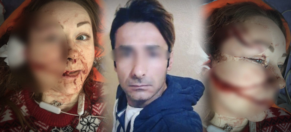 Boşanmak isteyen eşini falçatayla bu hale getirdi! Tutuklandı...