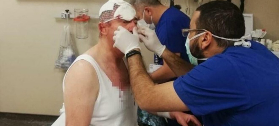 Gelecek Partili Selçuk Özdağ'a saldırıyla ilgili 2 şüpheli tutuklandı...