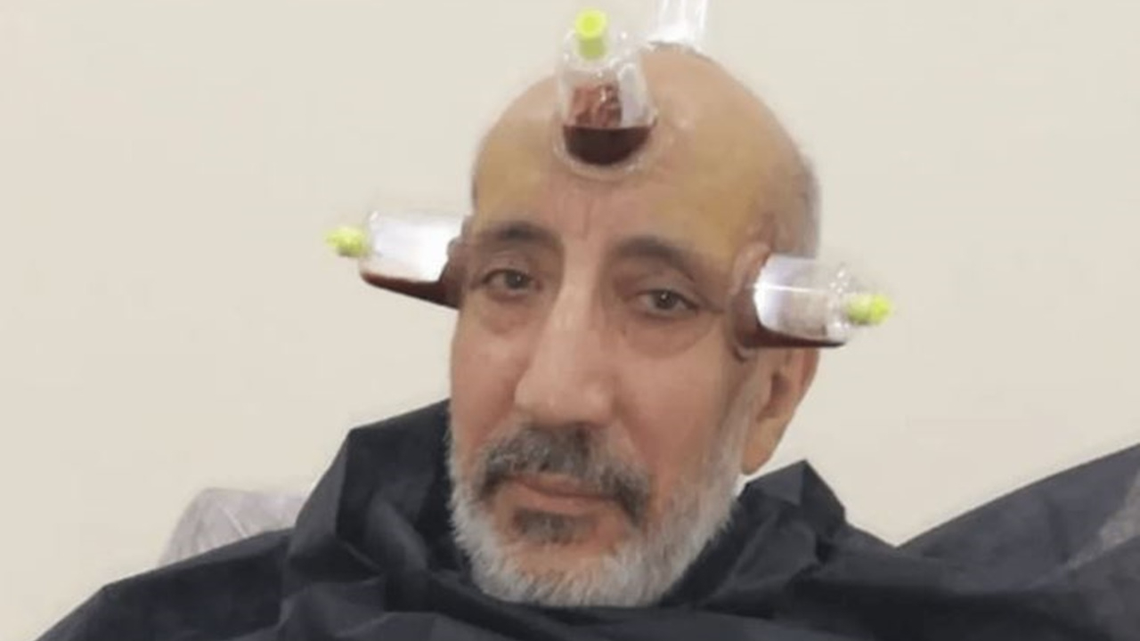 Akit yazarı Dilipak'tan fotoğraf tepkisi