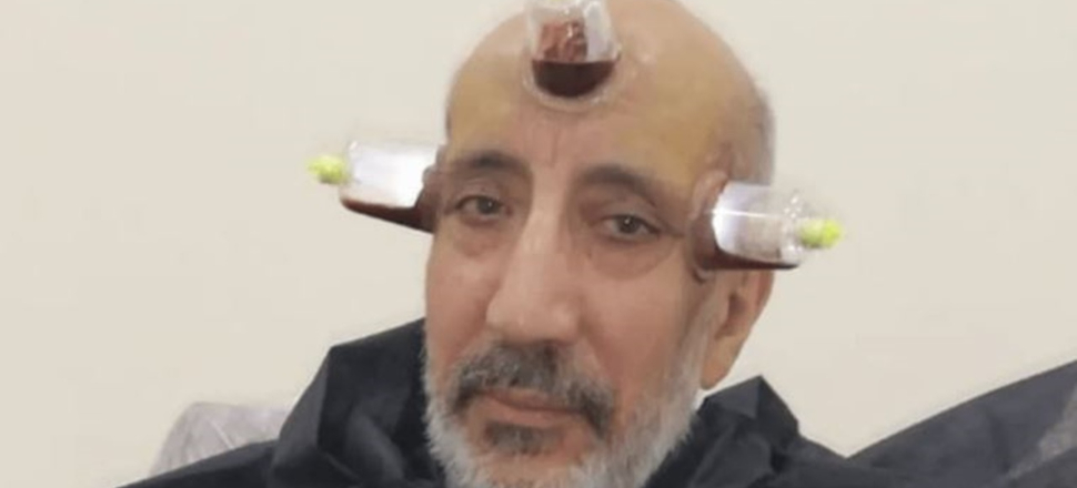 Akit yazarı Dilipak'tan fotoğraf tepkisi