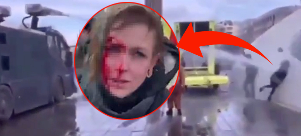 Hollanda'da polisin tazyikli suyla vurduğu kadının kafatası çatladı