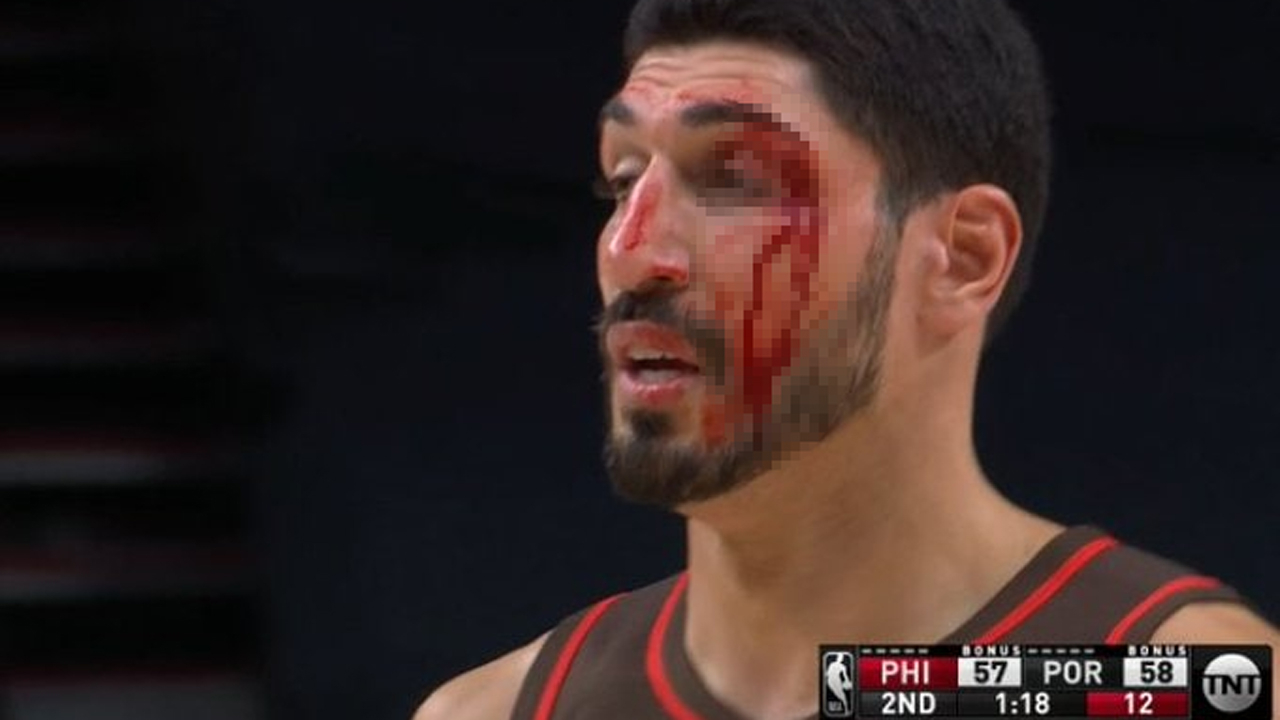 Enes Kanter kanlar içinde kaldı