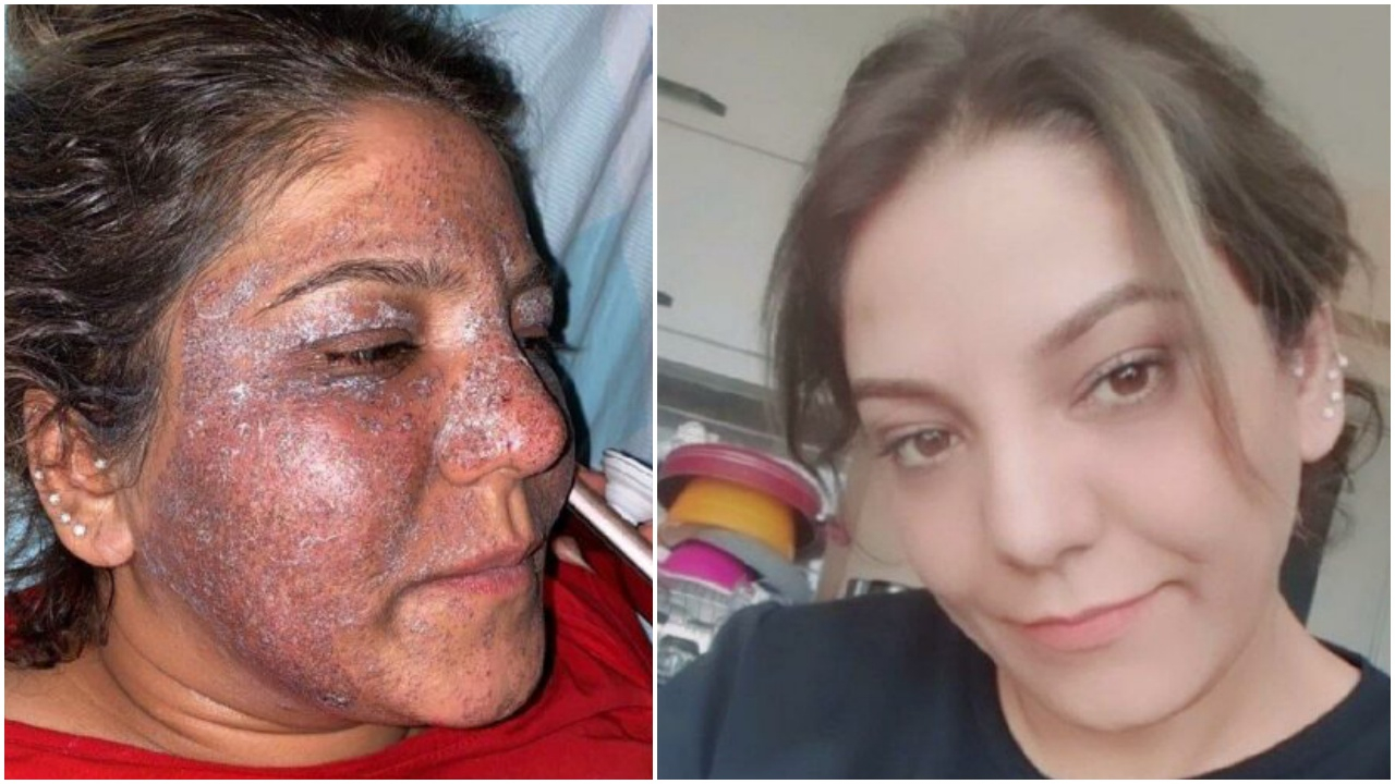 'Bebek gibi' olacaktı tanınmaz hale geldi