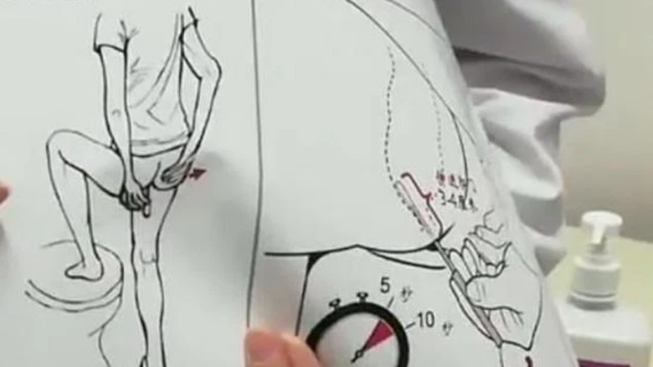 Ülkeye gidenlere anal test zorunluluğu