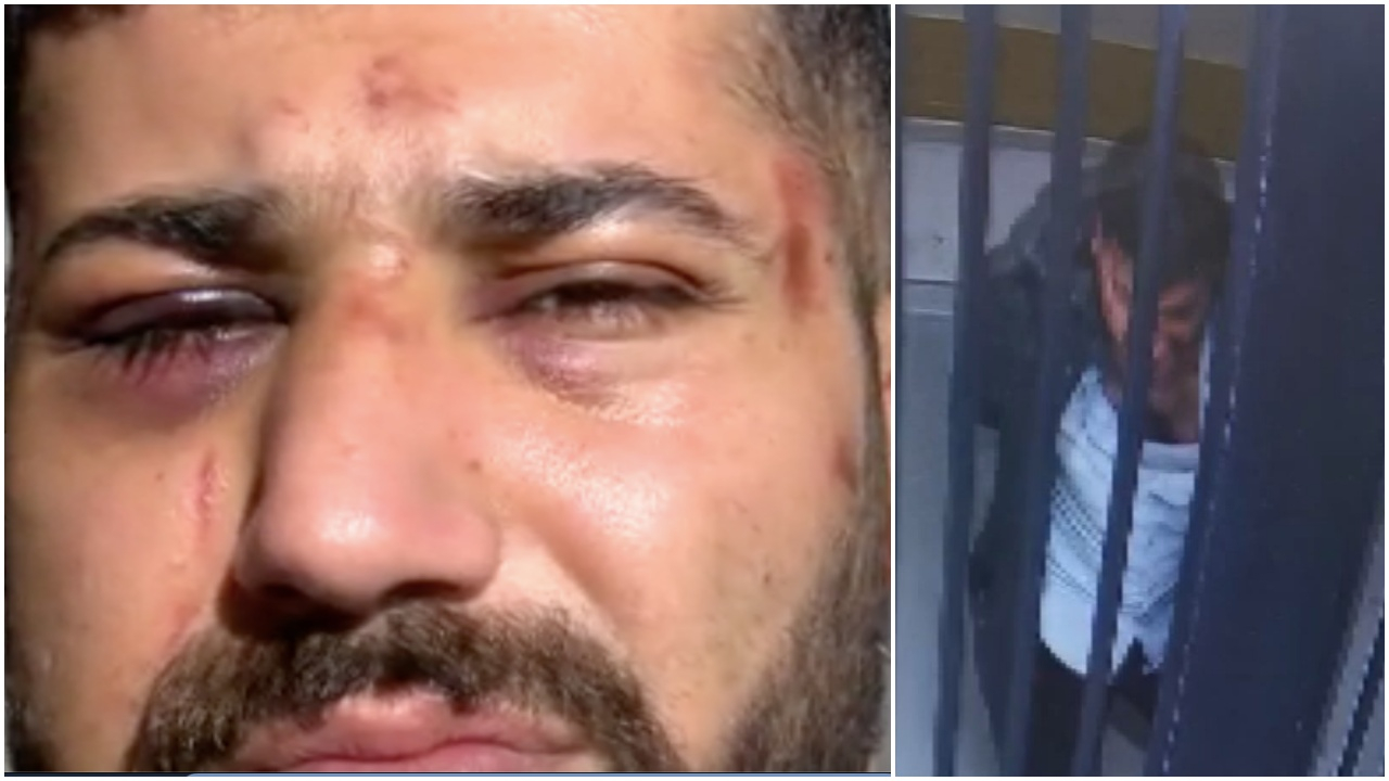 "Polis defalarca başıma vurdu" demişti