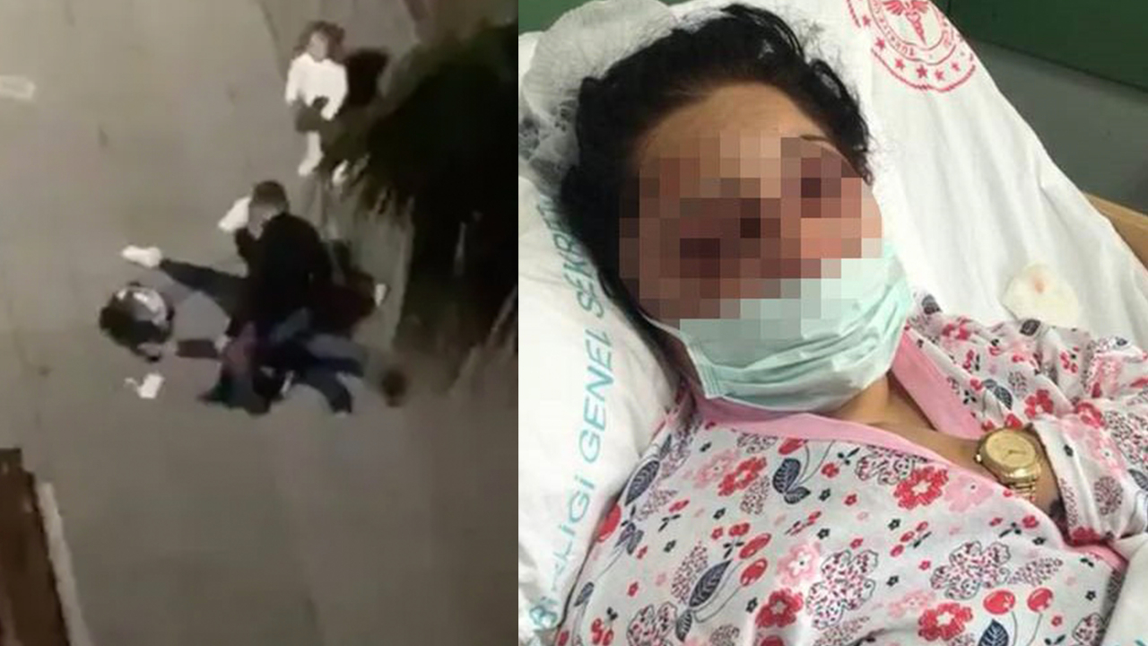 Eski eşi tarafından darp edilen kadın ilk kez konuştu