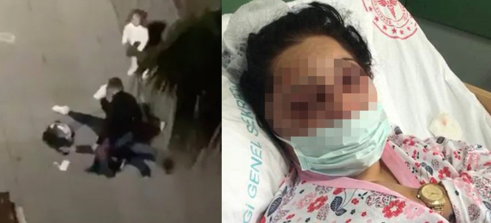 Eski eşi tarafından darp edilen kadın ilk kez konuştu