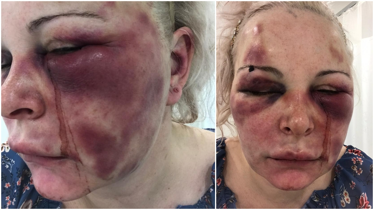Eline bulaşan kanları yalayıp 'Tadı ne güzel' dedi!