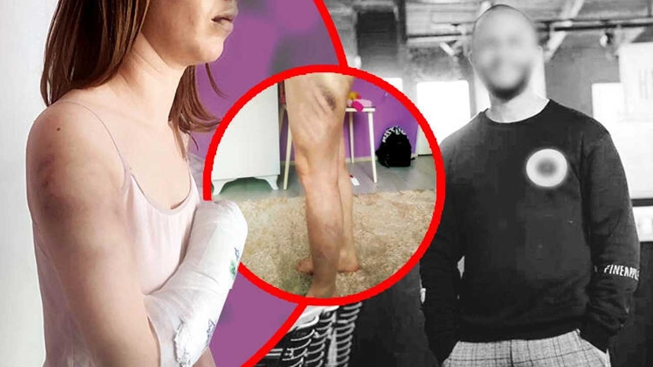 Sevgilisini beyzbol sopasıyla öldüresiye dövdü