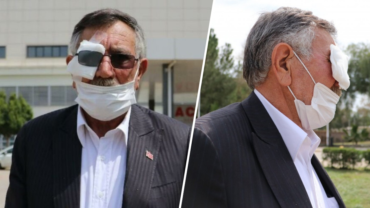 50 kuruş için bıçaklı saldırıya uğradı! Bir gözünü kaybetti...