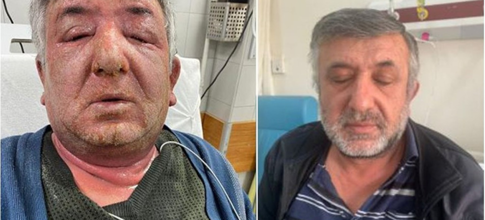 Taksiciye korona şüphesi şoku!