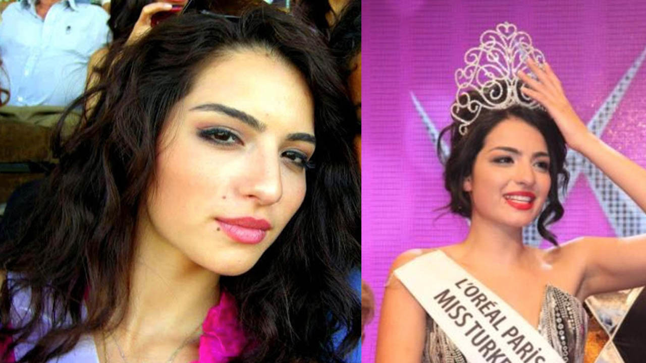 Melisa Aslı Pamuk estetik yaptırdı