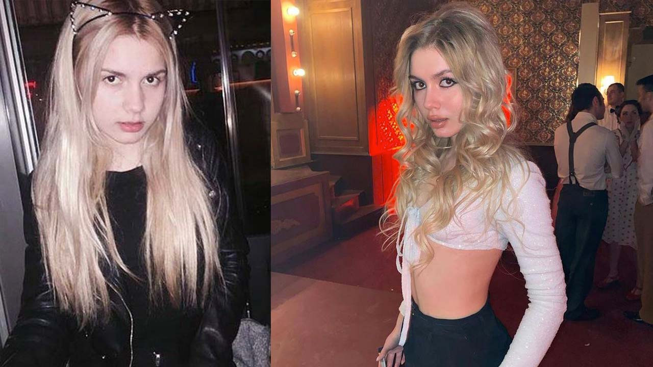Aleyna Tilki'nin dudakları sosyal medyayı karıştırdı
