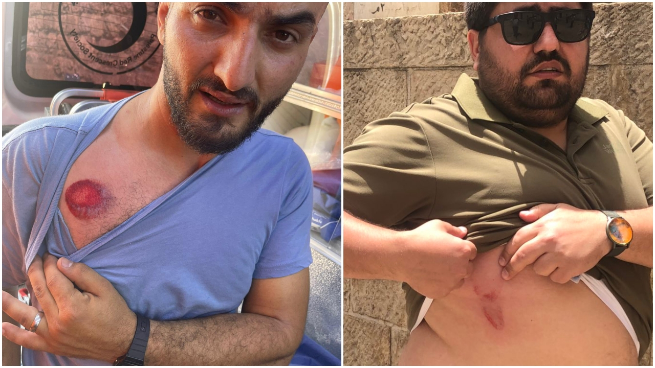 İsrail polisi Anadolu Ajansı çalışanlarını da yaraladı