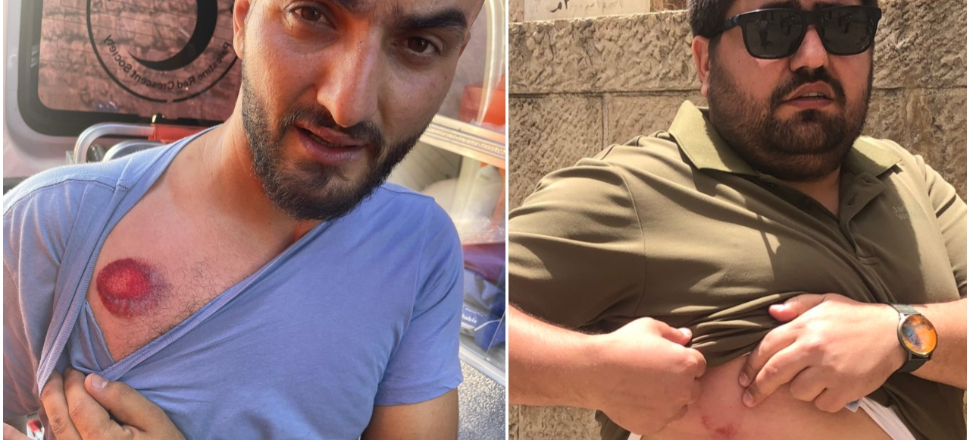 İsrail polisi Anadolu Ajansı çalışanlarını da yaraladı