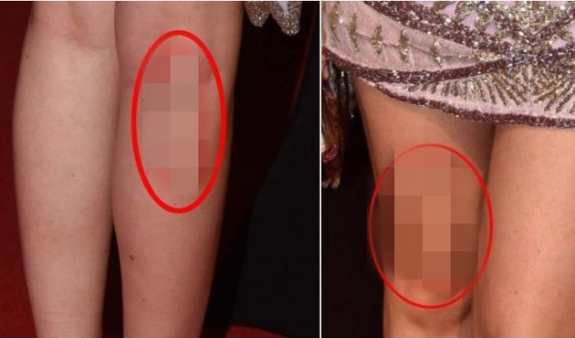 Fahriye Evcen’in başı bacaklarıyla dertte...