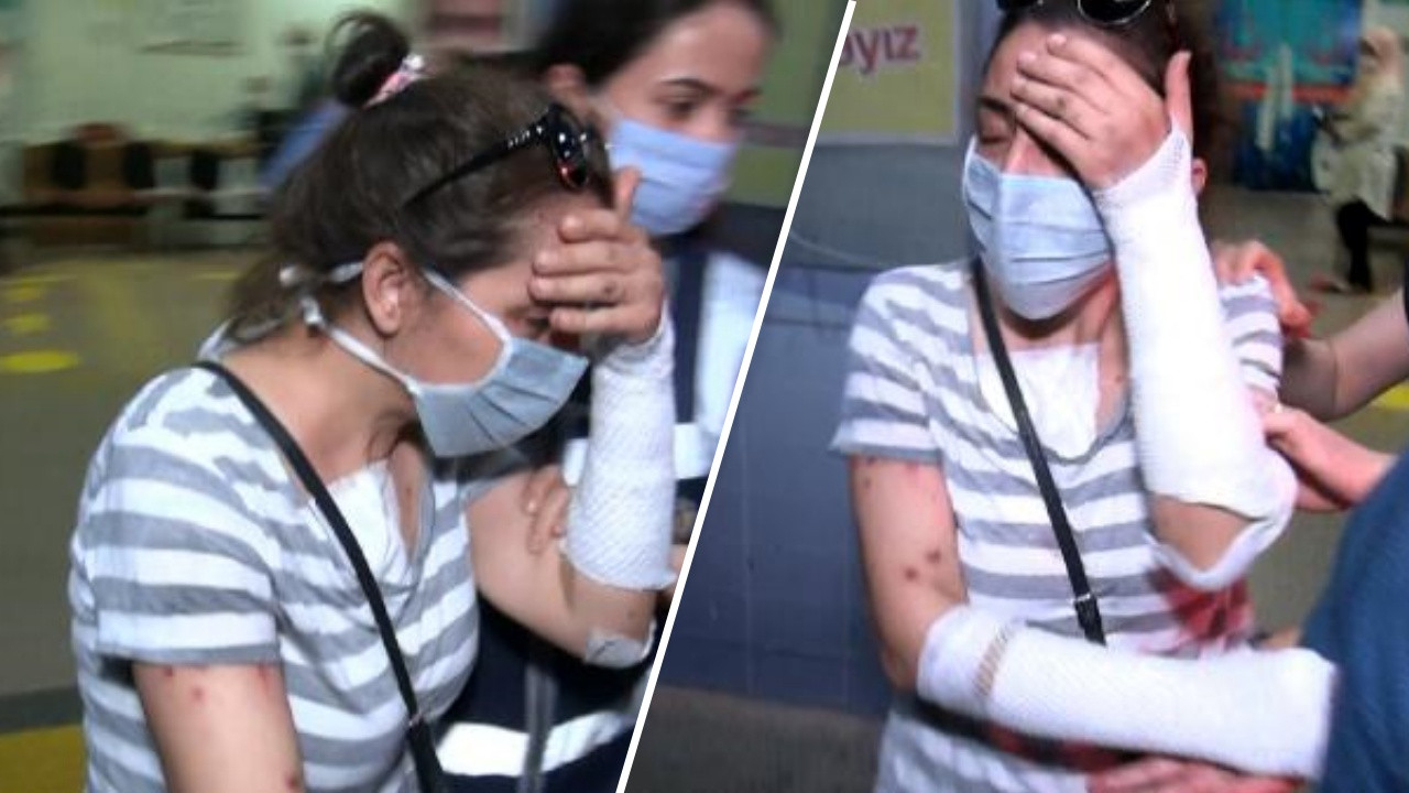 'Cinsel ilişki sırasında videomu çekti' diyerek eski sevgilisinin yüzüne kezzap attı!