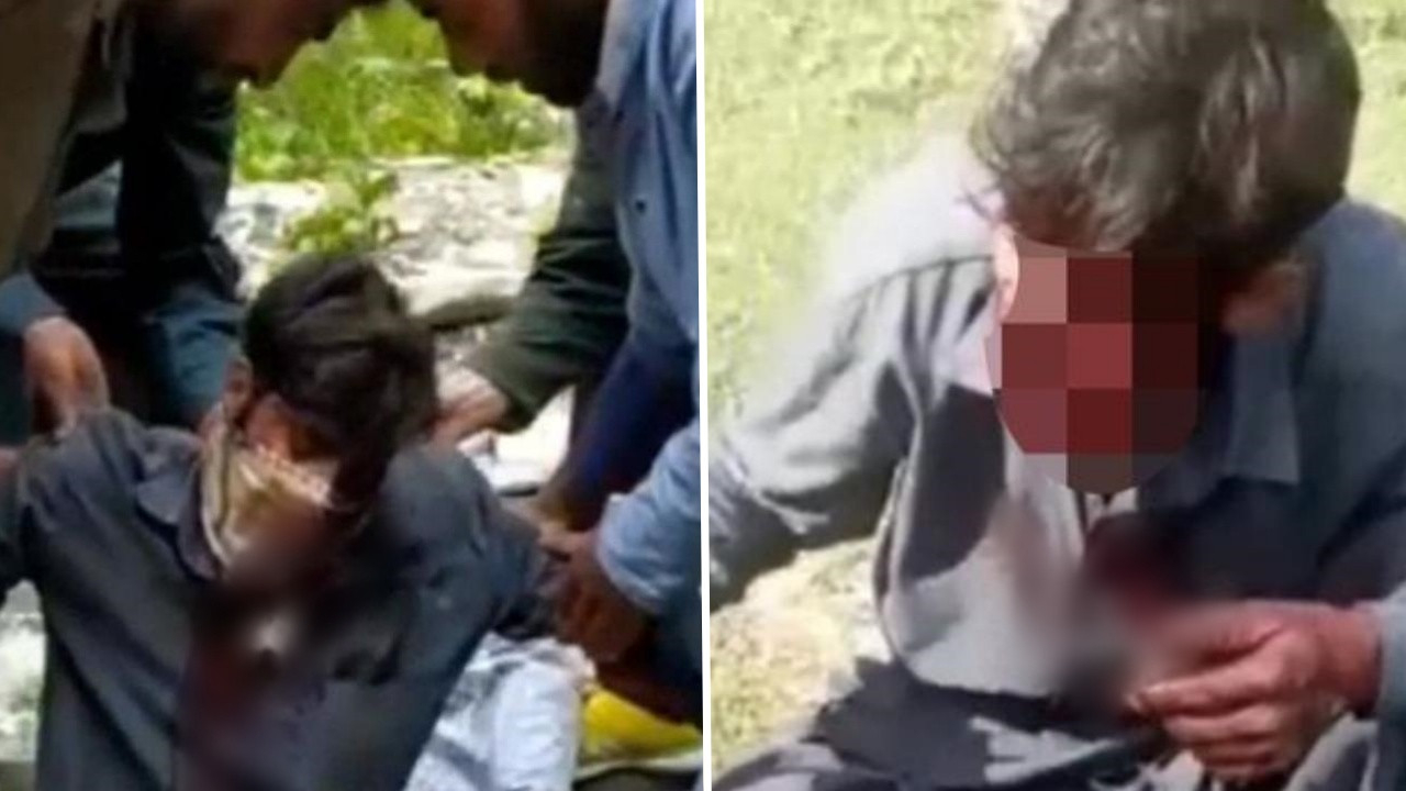 Vahşi ayı çobanın yüzünü parçaladı, gözünü oydu! Talihsiz adam ne olduğunu anlamadı!