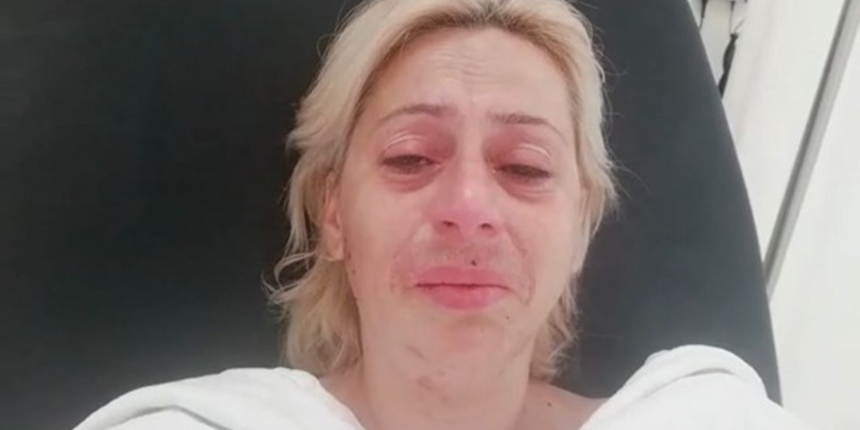 Sokak hayvanlarını besleyen kadının çenesini kırdılar!