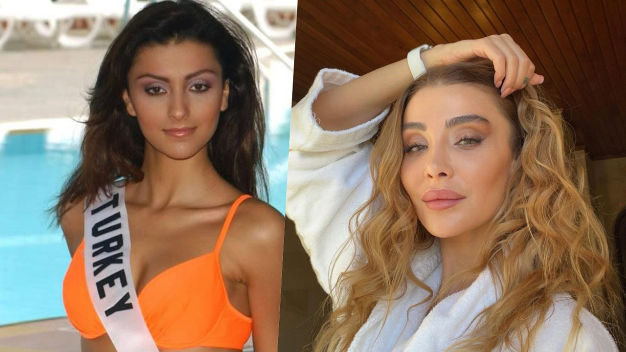 Estetik sonrası inanılmaz değişim! Özge Ulusoy'un son hali şaşkına çevirdi