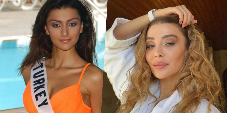 Estetik sonrası inanılmaz değişim! Özge Ulusoy'un son hali şaşkına çevirdi