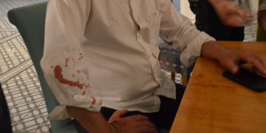CHP'li belediye başkanına beyzbol sopalı saldırı!