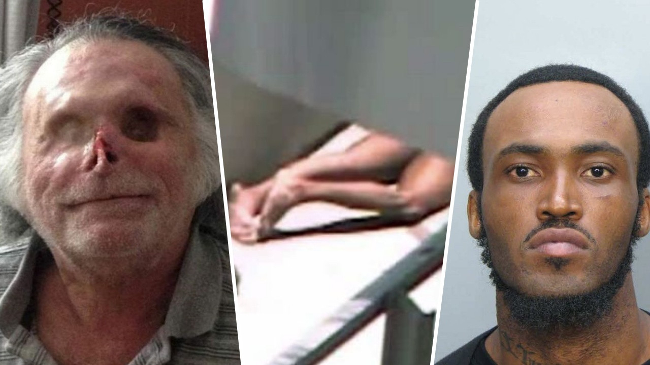 Böyle canilik görülmedi: Yamyam, evsiz adamın canlı canlı suratını yedi!