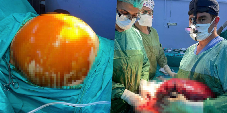 Safra kesesi şikayetiyle doktora gitti, ameliyattan 16 kilo vererek çıktı!