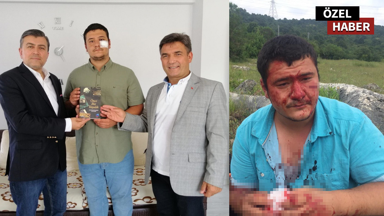 UYGAD, saldırıya uğrayan İHA muhabiri Mustafa Uslu'nun yanında