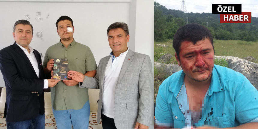 UYGAD, saldırıya uğrayan İHA muhabiri Mustafa Uslu'nun yanında